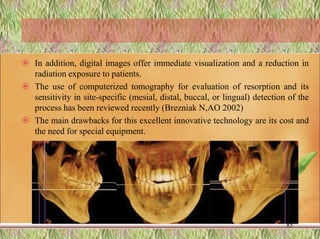  In addition, digital images offer immediate visualization and a reduction in
radiation exposure to patients.
 The use of computerized tomography for evaluation of resorption and its
sensitivity in site-specific (mesial, distal, buccal, or lingual) detection of the
process has been reviewed recently (Brezniak N,AO 2002)
 The main drawbacks for this excellent innovative technology are its cost and
the need for special equipment.
85
 