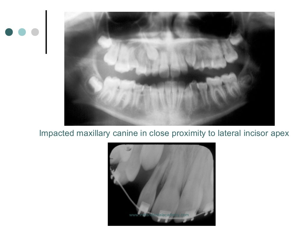 Root resorption in orthodontics /certified fixed orthodontic courses…