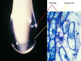 Mucilage Slough Cells 
 