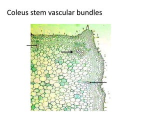 Coleus stem vascular bundles 
 