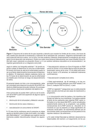 Figura 1. Esquema de la retina de los ojos izquierdo y derecho que muestra los límites de las zonas y las horas de
reloj usadas para describir la localización y extensión de la retinopatía del prematuro. Diagrama representativo del
área potencial total de la retina, con la Zona I (la más posterior) rodeando simétricamente la emergencia del nervio
óptico (la de desarrollo más temprano). Existe una mayor área temporal (lateralmente) que nasal (medial) (Zona III).
Del lado nasal, solamente se presentan Zonas I y II. Los cambios retinianos discutidos en la recomendación f, se
registran generalmente en un diagrama como éste.

según lo define una fotografía estándar13. Se tendrá es-       • Vascularización retiniana en Zona III lograda sin ROP
pecial cuidado al determinar la zona de la enfermedad.         previa en Zonas I ó II (si existe alguna duda de parte del
El número de horas de reloj de la enfermedad puede no          examinador acerca de la zona, o si la edad post-mens-
ser ya el factor determinante al recomendar el tratamien-      trual es menor a 35 semanas, se realizarán exámenes
to ablativo. El tratamiento debiera realizarse dentro de       confirmatorios).
las 72 horas de la determinación de que la enfermedad
es tratable para minimizar el riesgo de desprendimiento        • Vascularización completa de la retina.
de retina.
                                                               • Edad post-menstrual de 45 semanas y no hay en-
El paciente tratado con foto o con criocoagulación, debe       fermedad Pre-Umbral (definida como ROP estadio 3 en
ser controlado para observar la evolución de la ROP me-        Zona II, cualquier ROP en Zona I) o peor.
diante la oftalmoscopia binocular indirecta. Es aconseja-
ble la primera observación alrededor del séptimo día.          • ROP en regresión15 (asegurarse que no está presente
                                                               tejido vascular anormal que sea capaz de reactivación y
A los quince días se puede inferir cuál va a ser la evolu-     progresión).
ción de la ROP a partir de la aparición de algunos signos
de regresión:                                                  i. La comunicación entre los padres y los miembros del
                                                               Equipo de Salud es muy importante. Los padres estarán
•	   disminución de la tortuosidad y dilatación vascular;      al tanto de los exámenes para detectar ROP, serán in-
                                                               formados si su hijo desarrolla ROP y serán actualizados
•	   disminución de los vasos iridianos; y                     posteriormente acerca de su progresión. Las posibles
                                                               consecuencias de la ROP severa se discutirán en el
•	   vascularización en zona anterior al SHUNT.                momento en que se presenta un riesgo significativo de
                                                               evolución visual pobre. Se recomienda además que se
h. El cese de los exámenes para la pesquisa en etapa           documenten estas conversaciones con los padres en los
aguda se decidirá sobre la base de la edad y los hallaz-       reportes médicos ó de enfermería.
gos oftalmológicos14. Los hallazgos que sugieren que los
exámenes pueden discontinuarse incluyen los siguien-           j. En cada Unidad Neonatal se definirán claramente los
tes:                                                           responsables del examen y el seguimiento de los pa-



                                             Prevención de la ceguera en la infancia por Retinopatía del Prematuro (ROP) | 39
 