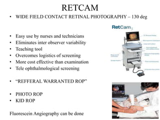 Rop Ret Camera Rop Retinopathy of prematurity | PPTX