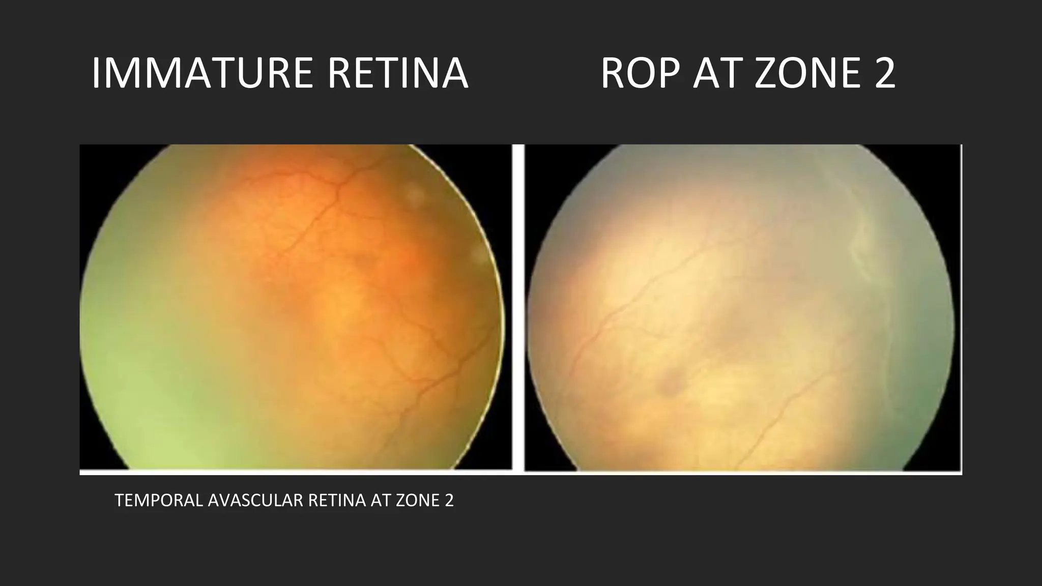 Phoenix Retina Camera Rop rop.pptx