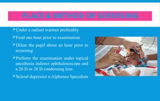 Retinopathy of prematurity ICROP 3 guidelines | PPTX