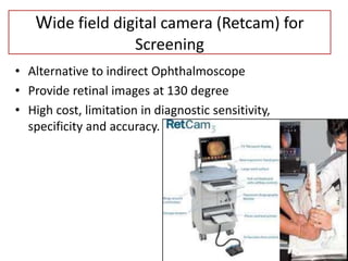 Rop Ret Camera Retinopathy of Prematurity | PPTX