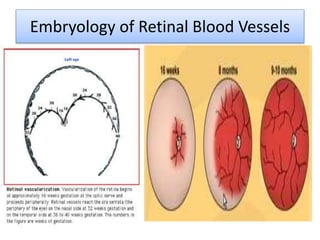 Blood Rop Retinopathy of Prematurity | PPTX