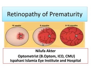 Retinopathy of Prematurity
Nilufa Akter
Optometrist (B.Optom, ICO, CMU)
Ispahani Islamia Eye Institute and Hospital
 