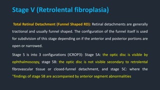 Stage V (Retrolental fibroplasia)
Total Retinal Detachment (Funnel Shaped RD): Retinal detachments are generally
tractional and usually funnel shaped. The configuration of the funnel itself is used
for subdivision of this stage depending on if the anterior and posterior portions are
open or narrowed.
Stage 5 is into 3 configurations (ICROP3): Stage 5A: the optic disc is visible by
ophthalmoscopy, stage 5B: the optic disc is not visible secondary to retrolental
fibrovascular tissue or closed-funnel detachment, and stage 5C: where the
"findings of stage 5B are accompanied by anterior segment abnormalities
 