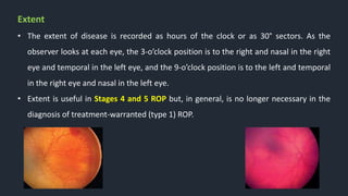 Extent
• The extent of disease is recorded as hours of the clock or as 30° sectors. As the
observer looks at each eye, the 3-o’clock position is to the right and nasal in the right
eye and temporal in the left eye, and the 9-o’clock position is to the left and temporal
in the right eye and nasal in the left eye.
• Extent is useful in Stages 4 and 5 ROP but, in general, is no longer necessary in the
diagnosis of treatment-warranted (type 1) ROP.
 