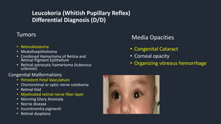 Leucokoria (Whitish Pupillary Reflex)
Differential Diagnosis (D/D)
• Retinoblastoma
• Medulloepithelioma
• Combined Hamartoma of Retina and
Retinal Pigment Epithelium
• Retinal astrocytic hamartoma (tuberous
sclerosis)
Congenital Malformations
• Persistent Fetal Vasculature
• Chorioretinal or optic nerve coloboma
• Retinal fold
• Myelinated retinal nerve fiber layer
• Morning Glory Anomaly
• Norrie disease
• Incontinentia pigmenti
• Retinal dysplasia
Tumors Media Opacities
• Congenital Cataract
• Corneal opacity
• Organizing vitreous hemorrhage
 