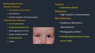 Retinal Detachment
Vascular diseases
• Retinopathy of prematurity
• Coats disease
• Familial exudative vitreoretinopathy
Inflammatory Diseases
• Ocular toxocariasis
• Congenital toxoplasmosis
• Cytomegalovirus retinitis
• Herpes simplex retinitis
• Endophthalmitis
• Uveitis
Trauma
• Commotio retinae
Refractive
• High myopia or anisometropia
Miscellaneous
• Strabismus (Brückner’s
phenomenon)
• Photographic artifact
• Pseudoleukocoria due to optic
nerve reflex
 