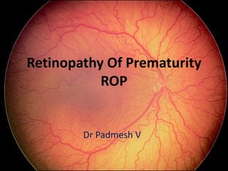 Retinopathy Of Prematurity
ROP
Dr Padmesh V
 