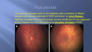 Vascular Ridge Rop Rop final | PPTX