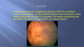 Agressive Rop Rop final | PPTX