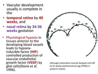 • Vascular development
usually is complete in
the
• temporal retina by 40
weeks, and
• nasal retina by 34-36
weeks gestation
although maturation may be delayed until 48
to 52 weeks postmenstrual age (PMA) in
preterm infants
• Physiological hypoxia in
tissues anterior to the
developing blood vessels
leads to hypoxia-
inducible factor (HIF)-
controlled production of
vascular endothelial
growth factor (VEGF) by
glial cells(Stone et al.
1996).
 