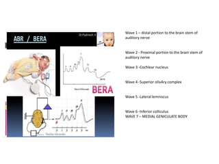 Wave 1 – distal portion to the brain stem of
auditory nerve
Wave 2 - Proximal portion to the brain stem of
auditory nerve
Wave 3 -Cochlear nucleus
Wave 4 -Superior olivAry complex
Wave 5 -Lateral lemniscus
Wave 6 -Inferior colliculus
WAVE 7 – MEDIAL GENICULATE BODY
 