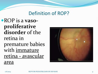 RETINOPATHY OF PREMATURITY FOR PEDIATRICIANS | PPTX