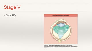 Total R&d Eye Retinopathy of Prematurity | PPTX