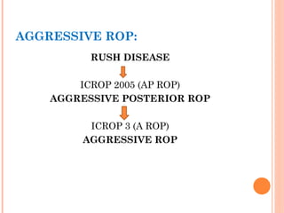 Agressive Rop Retinopathy of prematurity presentation. | PPTX