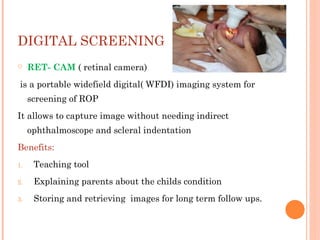 Rop Ret Camera Retinopathy of prematurity presentation. | PPTX