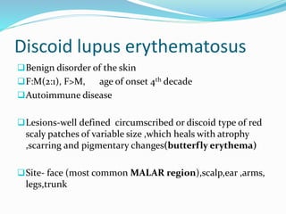 Lupus Rash Distribution Rosacea and lymphocytic infiltration disorders | PPTX