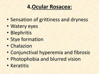 4.Ocular Rosacea:
• Sensation of grittiness and dryness
• Watery eyes
• Blephritis
• Stye formation
• Chalazion
• Conjunctival hyperemia and fibrosis
• Photophobia and blurred vision
• Keratitis
 