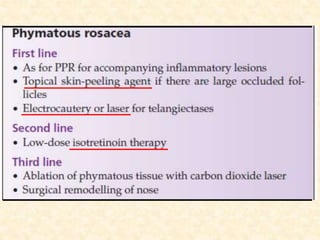 Rosacea: Inflammatory condition in Dermatology