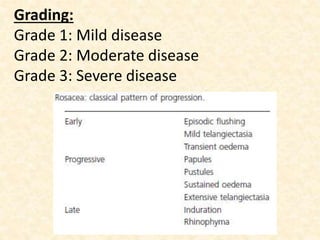 Grading:
Grade 1: Mild disease
Grade 2: Moderate disease
Grade 3: Severe disease
 