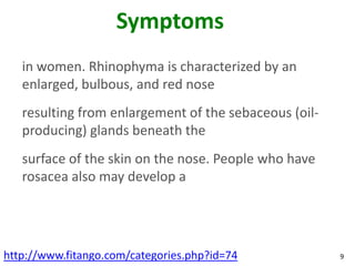Symptoms
   in women. Rhinophyma is characterized by an
   enlarged, bulbous, and red nose
   resulting from enlargement of the sebaceous (oil-
   producing) glands beneath the
   surface of the skin on the nose. People who have
   rosacea also may develop a




http://www.fitango.com/categories.php?id=74            9
 
