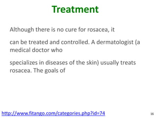 Treatment
   Although there is no cure for rosacea, it
   can be treated and controlled. A dermatologist (a
   medical doctor who
   specializes in diseases of the skin) usually treats
   rosacea. The goals of




http://www.fitango.com/categories.php?id=74              16
 