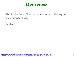 Overview
   affects the face. Skin on other parts of the upper
   body is only rarely
   involved.




http://www.fitango.com/categories.php?id=74             2
 