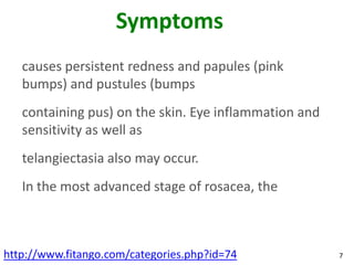 Symptoms
   causes persistent redness and papules (pink
   bumps) and pustules (bumps
   containing pus) on the skin. Eye inflammation and
   sensitivity as well as
   telangiectasia also may occur.
   In the most advanced stage of rosacea, the



http://www.fitango.com/categories.php?id=74            7
 