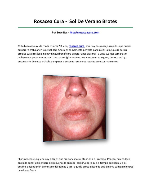 Rosacea cura