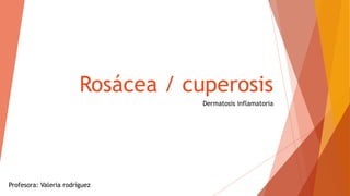Rosácea / cuperosis
Dermatosis inflamatoria
Profesora: Valeria rodríguez
 
