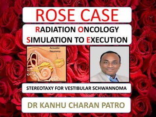 ROSE CASE
STEREOTAXY FOR VESTIBULAR SCHWANNOMA
RADIATION ONCOLOGY
SIMULATION TO EXECUTION
DR KANHU CHARAN PATRO
 
