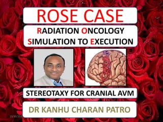 ROSE CASE
STEREOTAXY FOR CRANIAL AVM
RADIATION ONCOLOGY
SIMULATION TO EXECUTION
DR KANHU CHARAN PATRO
10/30/2020 1
 