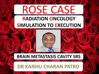 ROSE CASE
BRAIN METASTASIS CAVITY SRS
RADIATION ONCOLOGY
SIMULATION TO EXECUTION
DR KANHU CHARAN PATRO
 
