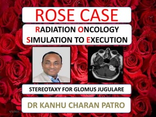 ROSE CASE
STEREOTAXY FOR GLOMUS JUGULARE
RADIATION ONCOLOGY
SIMULATION TO EXECUTION
DR KANHU CHARAN PATRO
4/5/2021 1
 