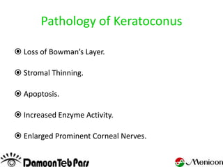 Pathology of Keratoconus

 Loss of Bowman’s Layer.

 Stromal Thinning.

 Apoptosis.

 Increased Enzyme Activity.

 Enlarged Prominent Corneal Nerves.
 