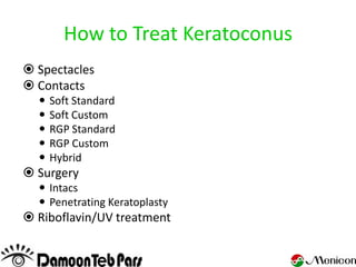 How to Treat Keratoconus
 Spectacles
 Contacts
     Soft Standard
     Soft Custom
     RGP Standard
     RGP Custom
     Hybrid
 Surgery
   Intacs
   Penetrating Keratoplasty
 Riboflavin/UV treatment
 