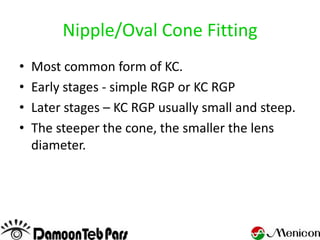 Nipple/Oval Cone Fitting
•   Most common form of KC.
•   Early stages - simple RGP or KC RGP
•   Later stages – KC RGP usually small and steep.
•   The steeper the cone, the smaller the lens
    diameter.
 