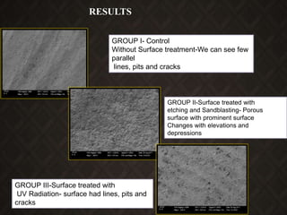 GROUP I- Control
Without Surface treatment-We can see few
parallel
lines, pits and cracks
GROUP II-Surface treated with
etching and Sandblasting- Porous
surface with prominent surface
Changes with elevations and
depressions
GROUP III-Surface treated with
UV Radiation- surface had lines, pits and
cracks
RESULTS
 