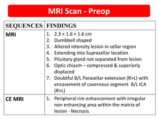 SRS-ROSE CASE FOR PITUITARY ADENOMA | PPTX