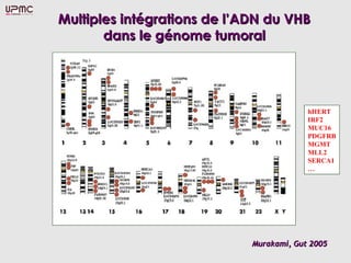Multiples intégrations de l’ADN du VHB
       dans le génome tumoral




                                          hHERT
                                          IRF2
                                          MUC16
                                          PDGFRB
                                          MGMT
                                          MLL2
                                          SERCA1
                                          …




                             Murakami, Gut 2005
 