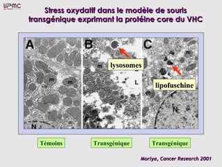 Stress oxydatif dans le modèle de souris
transgénique exprimant la protéine core du VHC




                      lysosomes

                                     lipofuschine




   Témoins       Transgénique       Transgénique

                                Moriya, Cancer Research 2001
 