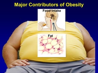 Major Contributors of Obesity
Food Intake
Fat
 