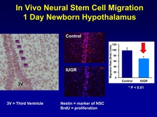 In Vivo Neural Stem Cell Migration
1 Day Newborn Hypothalamus
3V = Third Ventricle
Control IUGR
MigrationRate(BrdUCells)
0
20
40
60
80
100
120
*
3V
Nestin = marker of NSC
BrdU = proliferation
* P < 0.01
Control
IUGR
 