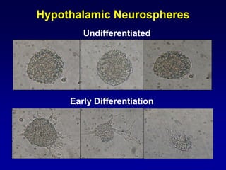 Hypothalamic Neurospheres
Undifferentiated
Early Differentiation
 