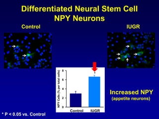 Differentiated Neural Stem Cell
NPY Neurons
NPYCells(%pertotalcells)
0
2
4
6
8
*
Control IUGR
Control IUGR
* P < 0.05 vs. Control
Increased NPY
(appetite neurons)
 