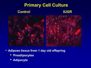 Primary Cell Culture
• Adipose tissue from 1 day old offspring
• Preadipocytes
• Adipocyte
Control IUGR
 